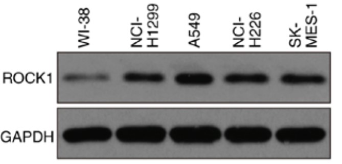 The expression level of ROCK1 was detected by western blotting in NSCLC cell lines.jpg